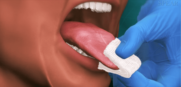 Oral Cancer Screening